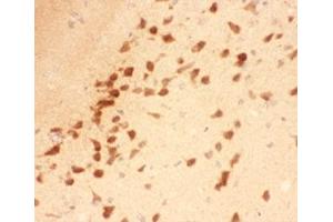 IHC-P testing of rat brain tissue (BDNF anticorps  (AA 129-247))