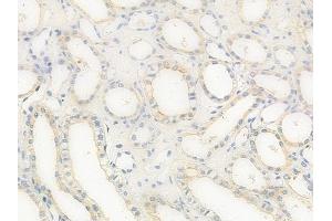 ABIN6258203 and ABIN6273889 at 1/100 staining human normal kidney tissue by IHC-P. (GPR68 anticorps  (Internal Region))