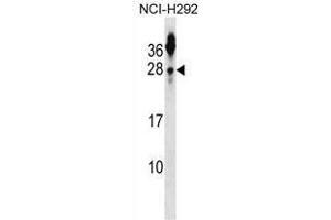TSPAN2 Antibody (N-term) western blot analysis in NCI-H292 cell line lysates (35 µg/lane). (Tetraspanin 2 anticorps  (N-Term))