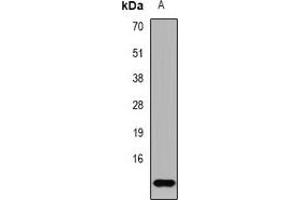 Western blot analysis of TF2A2 expression in NCIH460 (A) whole cell lysates. (GTF2A2 anticorps)