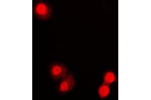 Immunofluorescent analysis of PML staining in COLO320 cells. (PML anticorps  (N-Term))