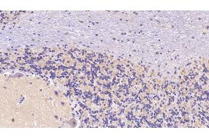 Detection of SEMA5B in Human Cerebellum Tissue using Polyclonal Antibody to Semaphorin 5B (SEMA5B)