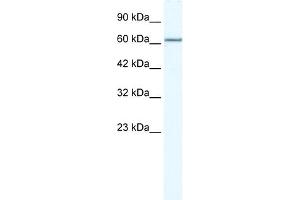 WB Suggested Anti-MCM5 Antibody Titration:  2. (MCM5 anticorps  (N-Term))