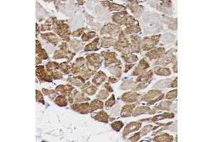 Immunohistochemistry of paraffin-embedded rat heart using Monoamine Oxidase B (MAOB) Rabbit pAb (ABIN3022151, ABIN3022152, ABIN3022153, ABIN1513172 and ABIN6218632) at dilution of 1:150 (40x lens).