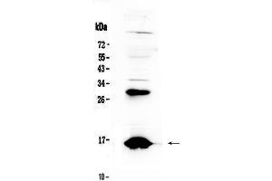 Western blot analysis of HBD using anti-HBD antibody .