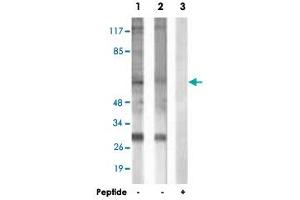Western blot analysis of extracts from HepG2 cells (Lane 1) and COLO 205 cells (Lane 2 and 3), using MITF polyclonal antibody . (MITF anticorps  (Ser73, Ser180))