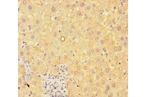 Immunohistochemistry of paraffin-embedded human liver tissue using ABIN7144096 at dilution of 1:100 (C19ORF80 anticorps  (AA 22-198))