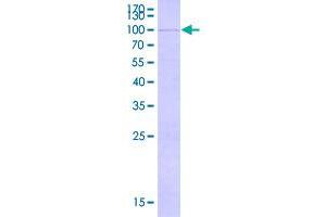 Image no. 1 for F-Box and WD Repeat Domain Containing 7 (FBXW7) (AA 1-553) protein (GST tag) (ABIN1990130)