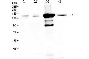 Western blot analysis of PRX using anti-PRX antibody . (Periaxin anticorps  (AA 1-91))