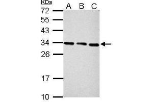 WB Image Sample (30 ug of whole cell lysate) A: NIH-3T3 B: JC C: BCL-1 12% SDS PAGE antibody diluted at 1:2000 (PSME3 anticorps)
