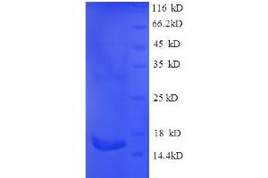 SDS-PAGE (SDS) image for Phospholipase A2, Group IIA (Platelets, Synovial Fluid) (PLA2G2A) (AA 22-146) protein (His-SUMO Tag) (ABIN5710784)