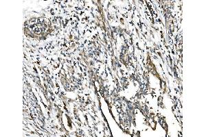 IHC analysis of GFPT1 using anti-GFPT1 antibody (ABIN7602887). (GFPT1 anticorps  (C-Term))