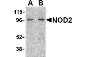 Image no. 2 for anti-Nucleotide-Binding Oligomerization Domain Containing 2 (NOD2) (C-Term) antibody (ABIN372922)