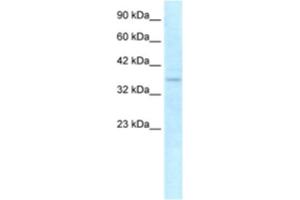 Western Blotting (WB) image for anti-NLR Family, CARD Domain Containing 4 (NLRC4) antibody (ABIN2463643) (NLRC4 anticorps)