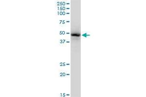 GATA1 monoclonal antibody (M06), clone 3G6.