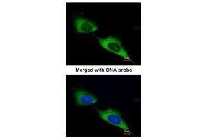 ICC/IF Image Immunofluorescence analysis of paraformaldehyde-fixed HeLa, using MTMR9, antibody at 1:200 dilution.