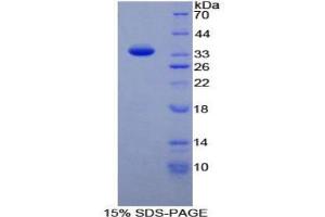 SDS-PAGE analysis of Human TAF1 Protein. (TAF1 Protéine)