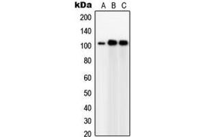 Western blot analysis of GPC5 expression in Jurkat (A), IMR32 (B), HeLa (C) whole cell lysates. (GPC5 anticorps  (Center))