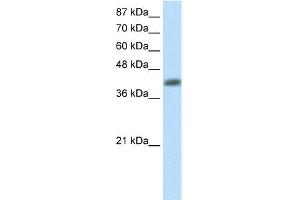 WB Suggested Anti-APTX Antibody Titration:  2. (Aprataxin anticorps  (C-Term))