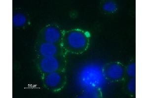 Expression of α1B-Adrenoceptor in GH3 cells - Cell surface detection of α1B-Adrenoceptor in living GH3 cells with Anti-α1B-Adrenergic Receptor (extracellular) Antibody (ABIN7042897, ABIN7043914 and ABIN7043915), followed by goat anti-rabbit-AlexaFluor-488 secondary antibody (green).