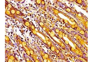 Immunohistochemistry of paraffin-embedded human small intestine tissue using ABIN7142689 at dilution of 1:100