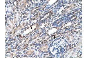 NOLC1 antibody was used for immunohistochemistry at a concentration of 4-8 ug/ml to stain Epithelial cells of renal tubule (arrows) in Human Kidney. (NOLC1 anticorps  (C-Term))