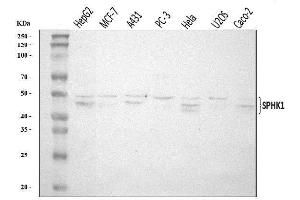 Western blot analysis of SPHK1 using anti-SPHK1 antibody (ABIN7600168).