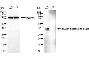 Western blotting analysis using N-acetylglucosamine kinase antibody (ABIN7799529). (NAGK anticorps)