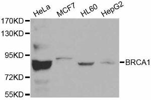 Western blot analysis of extracts of various cell lines, using BRCA1 antibody. (BRCA1 anticorps  (AA 120-220))