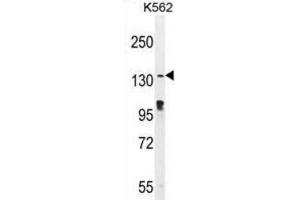 Western Blotting (WB) image for anti-OVOS1 antibody (ABIN2996287) (OVOS1 anticorps)