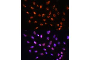 Immunofluorescence analysis of C6 cells using YY2 Rabbit pAb (ABIN7271429) at dilution of 1:100.