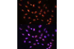 Immunofluorescence analysis of C6 cells using YY2 Rabbit pAb (ABIN7271429) at dilution of 1:100. (YY2 anticorps  (AA 200-300))