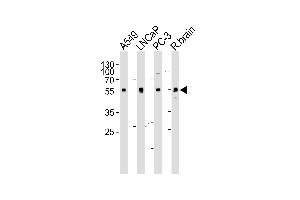 Western blot analysis of lysates from A549, LNCaP, PC-3 cell line and rat brain tissue lysate (from left to right), using ADRA1D Antibody (N-term) (ABIN1945085 and ABIN2838547).