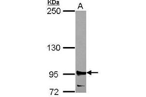 WB Image Sample (30 ug of whole cell lysate) A: 293T 5% SDS PAGE antibody diluted at 1:2000 (RRM1 anticorps  (Center))