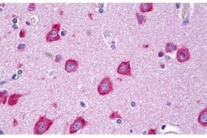 Anti-MLKL antibody IHC staining of human brain, cortex neurons. (MLKL anticorps  (AA 371-472))