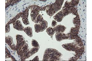 Image no. 1 for anti-Family with Sequence Similarity 164, Member A (FAM164A) antibody (ABIN1498198) (FAM164A anticorps)