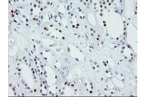 Image no. 3 for anti-SUMO1/sentrin/SMT3 Specific Peptidase 2 (SENP2) (AA 139-523) antibody (ABIN1490925)