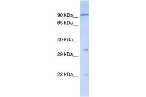 Host:  Rabbit  Target Name:  NIPSNAP3B  Sample Type:  Jurkat Whole Cell lysates  Antibody Dilution:  1. (NIPSNAP3B anticorps  (N-Term))