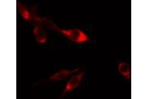 ABIN6274803 staining HepG2 cells by IF/ICC. (ACBD6 anticorps  (Internal Region))