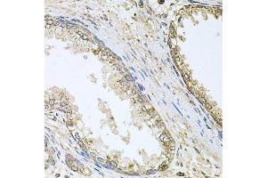 Immunohistochemistry of paraffin-embedded human prostate using CYP46A1 antibody (ABIN5996079) at dilution of 1/100 (40x lens).