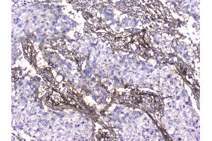 IHC analysis of Collagen IV using anti-Collagen IV antibody .