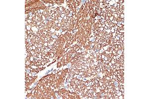 Immunohistochemistry of paraffin-embedded human brain using Syntaxin Rabbit mAb (ABIN7270685) at dilution of 1:100 (40x lens).
