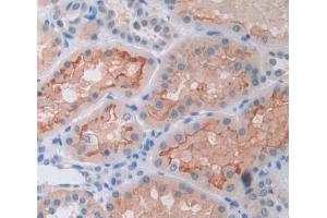 Used in DAB staining on fromalin fixed paraffin- embedded kidney tissue