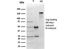SDS-PAGE Analysis Purified MICA Mouse Recombinant Monoclonal (MICA/4442). (MICA anticorps  (AA 1-200))