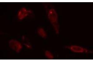 ABIN6275433 staining  COLO205 cells by IF/ICC. (CHML anticorps  (Internal Region))