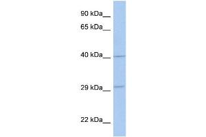 WB Suggested Anti-ART5 Antibody Titration:  0. (ART5 anticorps  (Middle Region))