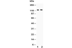 Western blot testing of BOC antibody and Lane 1:  mouse brain;  2: NIH3T3 lysate.