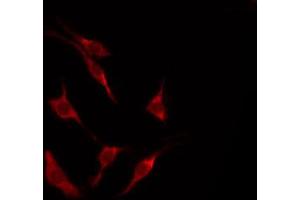 ABIN6267663 staining HeLa by IF/ICC.