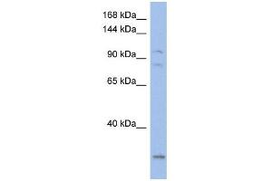 KCNQ5 antibody used at 1 ug/ml to detect target protein. (KCNQ5 anticorps  (Middle Region))