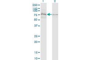 Western Blot analysis of ZDHHC8 expression in transfected 293T cell line by ZDHHC8 monoclonal antibody (M02), clone 1C5.